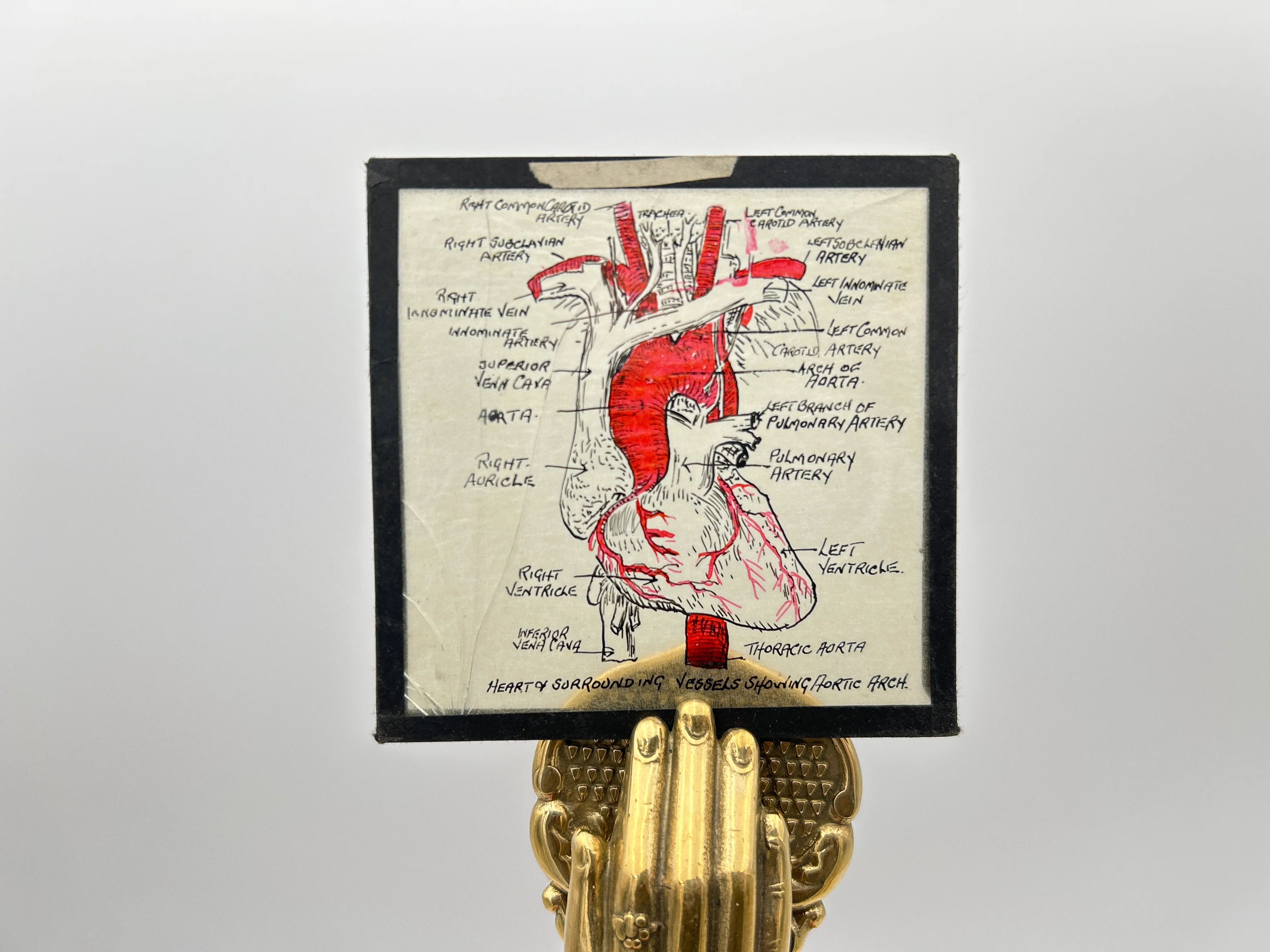 Human Anatomy Magic Lantern Lecture Slides - Image 2