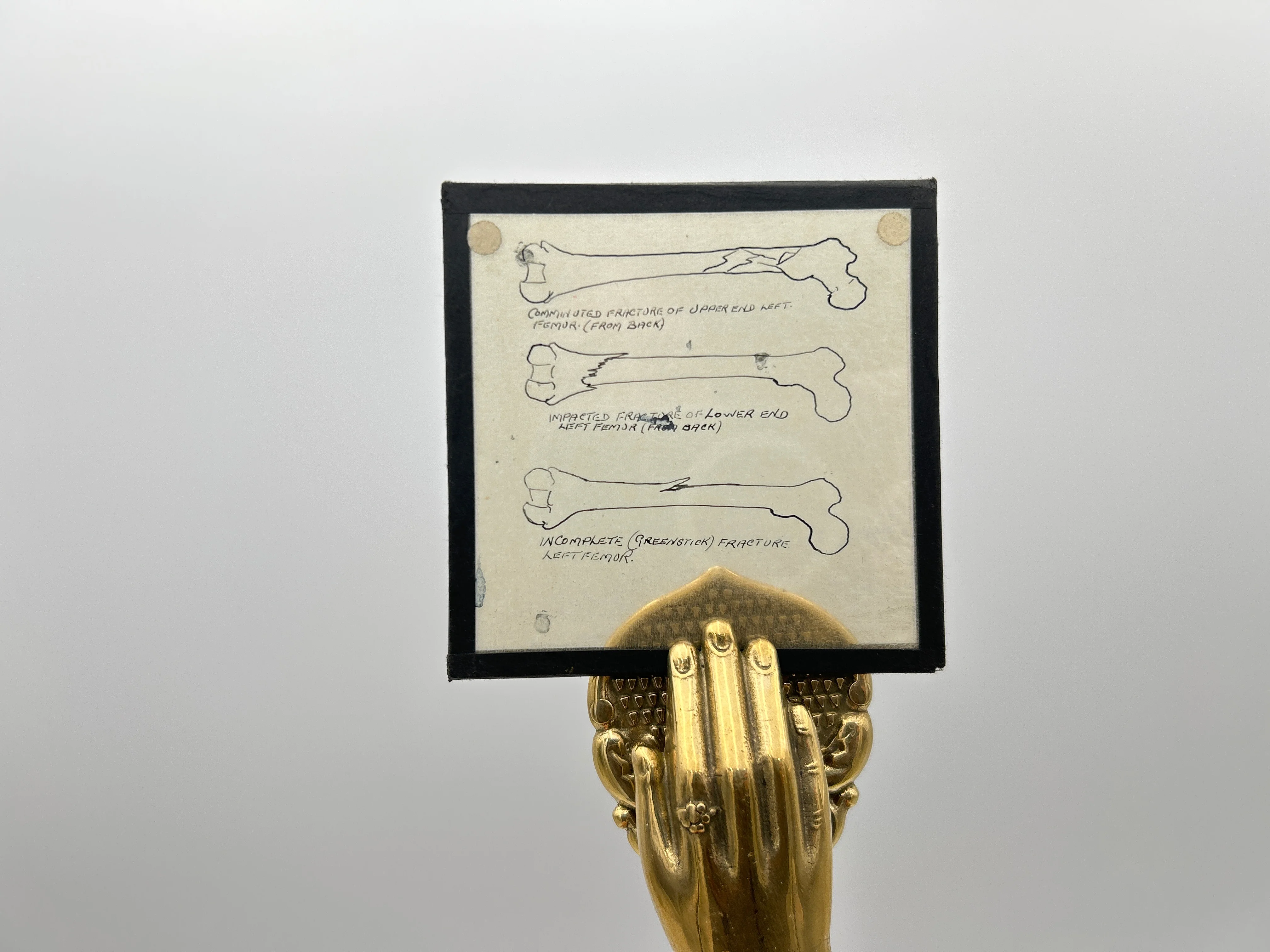 Human Anatomy Magic Lantern Lecture Slides - Image 3