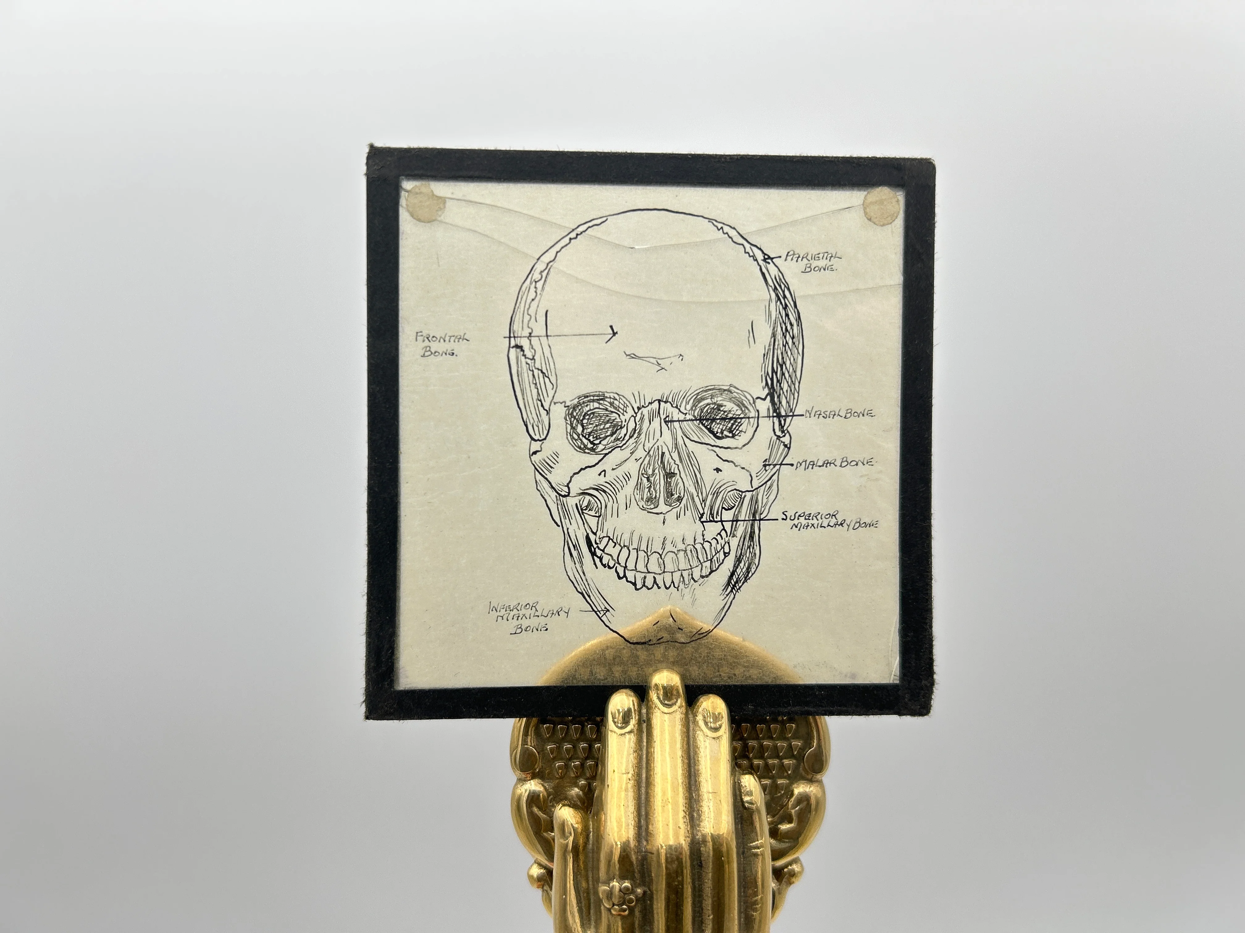Human Anatomy Magic Lantern Lecture Slides - Image 5